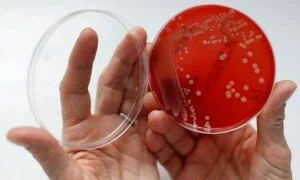 Julius Richard Petri: Google celebrates birth of inventor of the petri dish